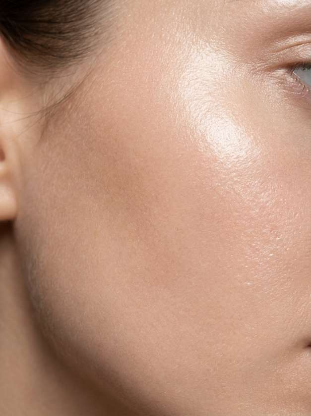 Birth Mark Removal Surgery