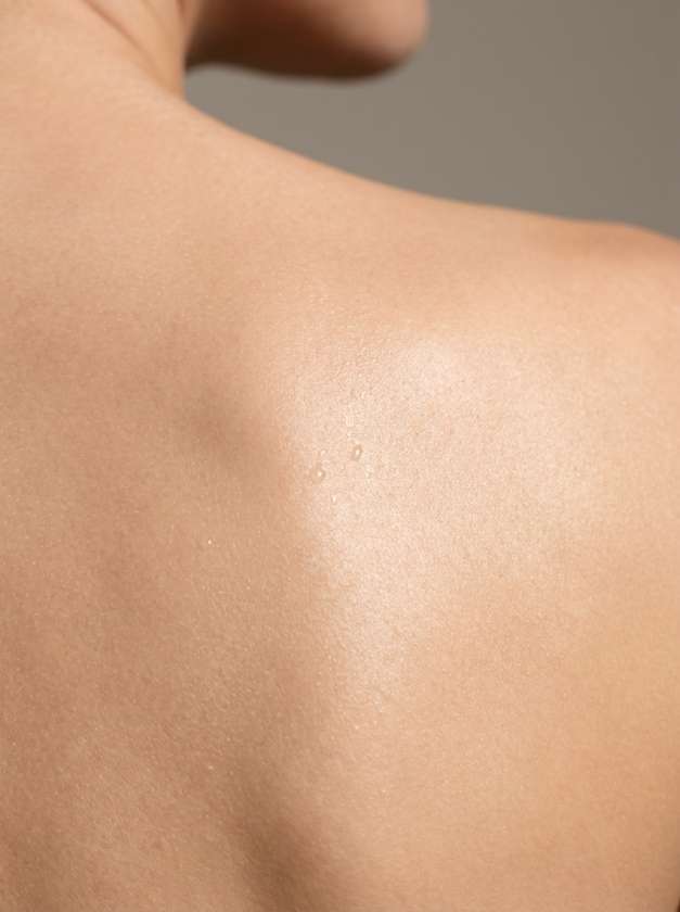 Lipoma Excision