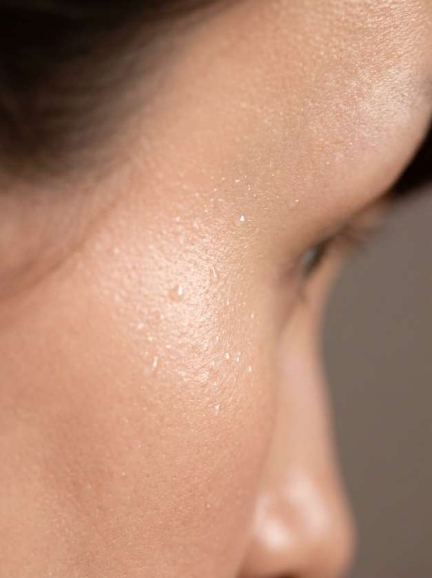 Sebaceous Cyst